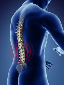 spine injury attorney san diego